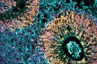 Неожиданная польза стресса: как ранние гормоны влияют на интеллект ребёнка