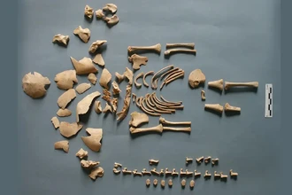 Ученые нашли шесть древних детей с синдромом Дауна, изучив ДНК