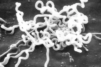 Сифилис в США: число заражений достигло максимума с середины XX века