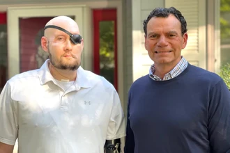 Успешная пересадка глаза и части лица: первая в мире операция