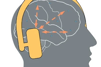 Нейроимпланты передают данные из мозга на компьютер без проводов